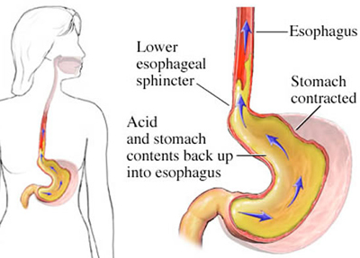 AGNI PANACEA AYURVEDA