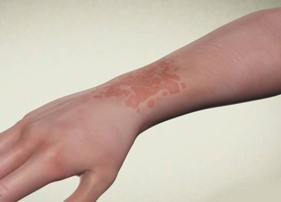 AGNI PANACEA AYURVEDA