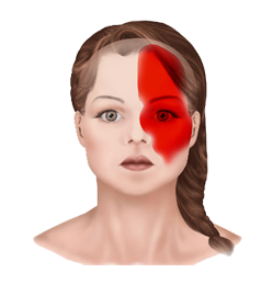 ayurvedic treatment in kerala for migraine headaches