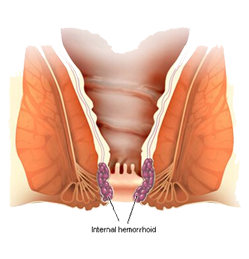 Agni Panacea Ayurveda